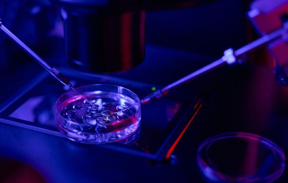 Transfer embrionale: l’ultimo passaggio della FIVET Transfer embrionale: l’ultimo passaggio della FIVET