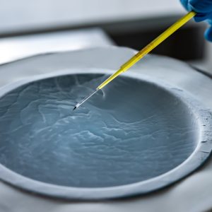 Chemioterapia e crioconservazione dello sperma Chemioterapia e crioconservazione dello sperma