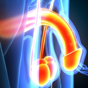 Ostruzione dei dotti seminali e infertilità maschile Ostruzione dei dotti seminali e infertilità maschile