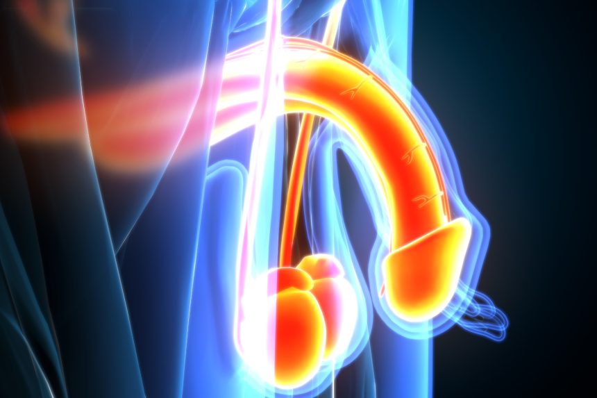 Ostruzione dei dotti seminali e infertilità maschile Ostruzione dei dotti seminali e infertilità maschile